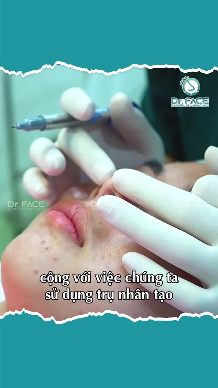 Muốn thấy MŨI BỊ LỘ SỤN? Xem ngay và liền ca này!