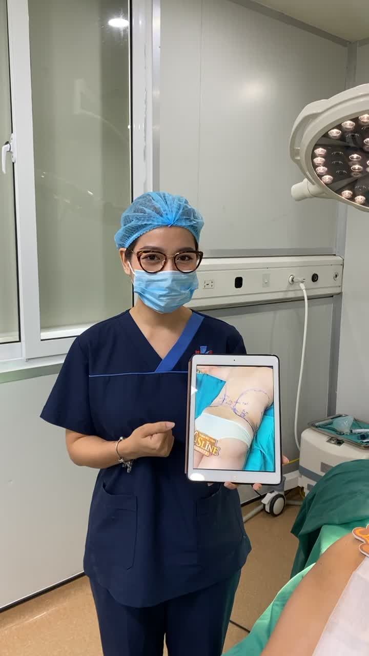 HÚT MỠ SIẾT EO 360