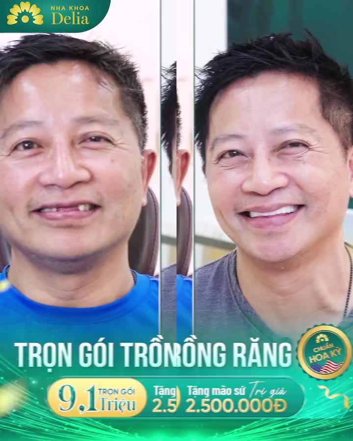 Trồng răng Implant AN TOÀN với ưu đãi ĐỘC QUYỀN tại DELIA