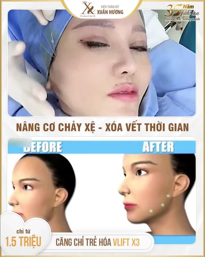 Trẻ hóa nâng cơ không cần phẫu thuật, bí quyết của Chủ tịch Xuân Hương để luôn tươi trẻ rạng rỡ