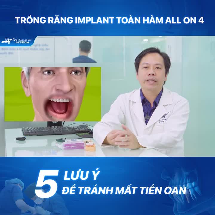 5 LƯU Ý QUAN TRỌNG KHI LỰA CHỌN TRỒNG RĂNG IMPLANT TOÀN HÀM ALL ON 4