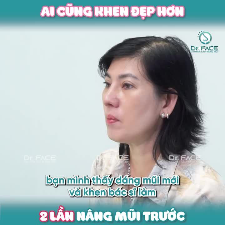 Ai cũng khen ĐẸP HƠN 2 LẦN nâng trước