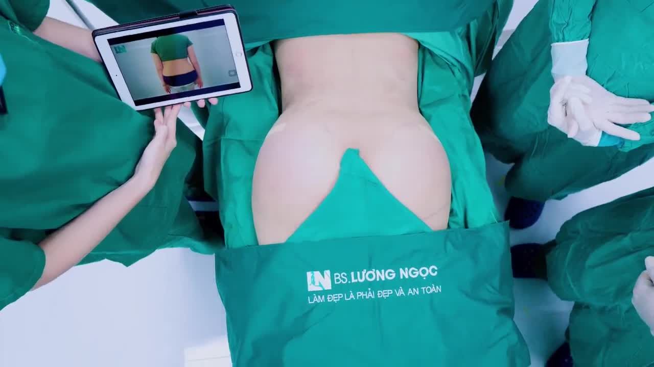 Chưa bao giờ ekip nâng niu những "bé MỠ" như lúc này!! Những thao tác từ việc lấy mỡ ra ngoài cũng rất cẩn trọng, tránh làm cho bé Mỡ bị dập, nát, tổn thương, nhằm tăng tỉ lệ sống cao nhất khi đưa "bé Mỡ" vào vùng mông cho khách!