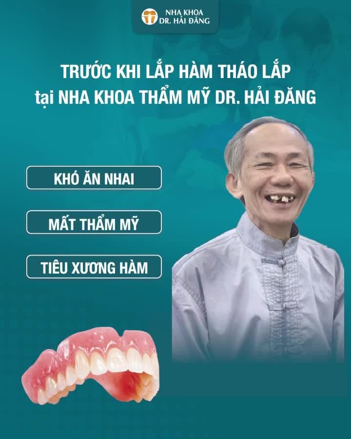 RĂNG GIẢI THÁO LẮP CAO CẤP - GIẢI PHÁP HOÀN HẢO CHO BẬC TRƯỞNG THÀNH