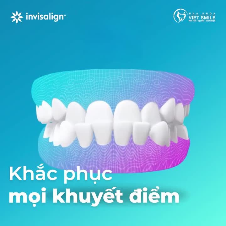 Bắt đầu hoàn thiện nụ cười cùng VIET SMILE chỉ với 10 triệ.u cùng nhiều quà tặng hấp dẫn