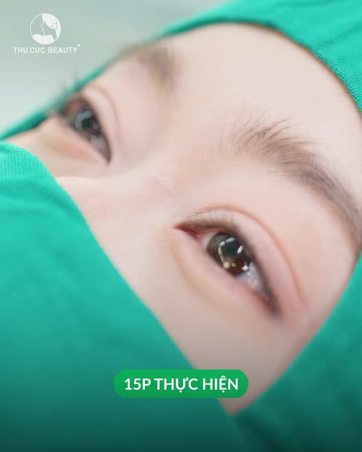 KH Diễm Trinh rạng ngời, tươi trẻ hơn sau cắt mí