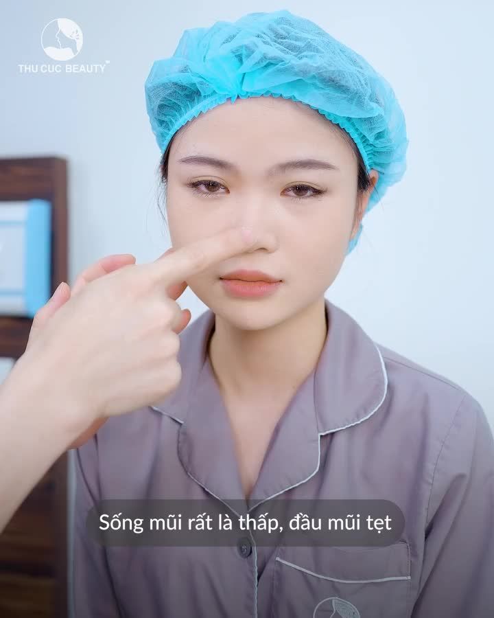 Chị em muốn "say bye" mũi tẹt, hãy đến ngay TM Thu Cúc