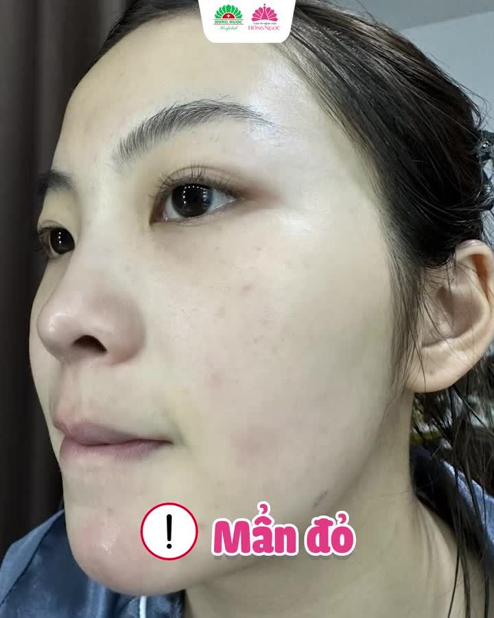 DA CĂNG KHỎE - BỪNG SỨC SỐNG NGAY HÔM NAY CÙNG MESO PERFECT FACE