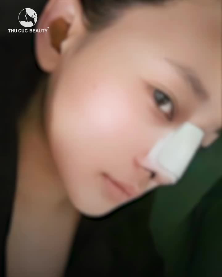 Thay dáng mũi đổi tài vận