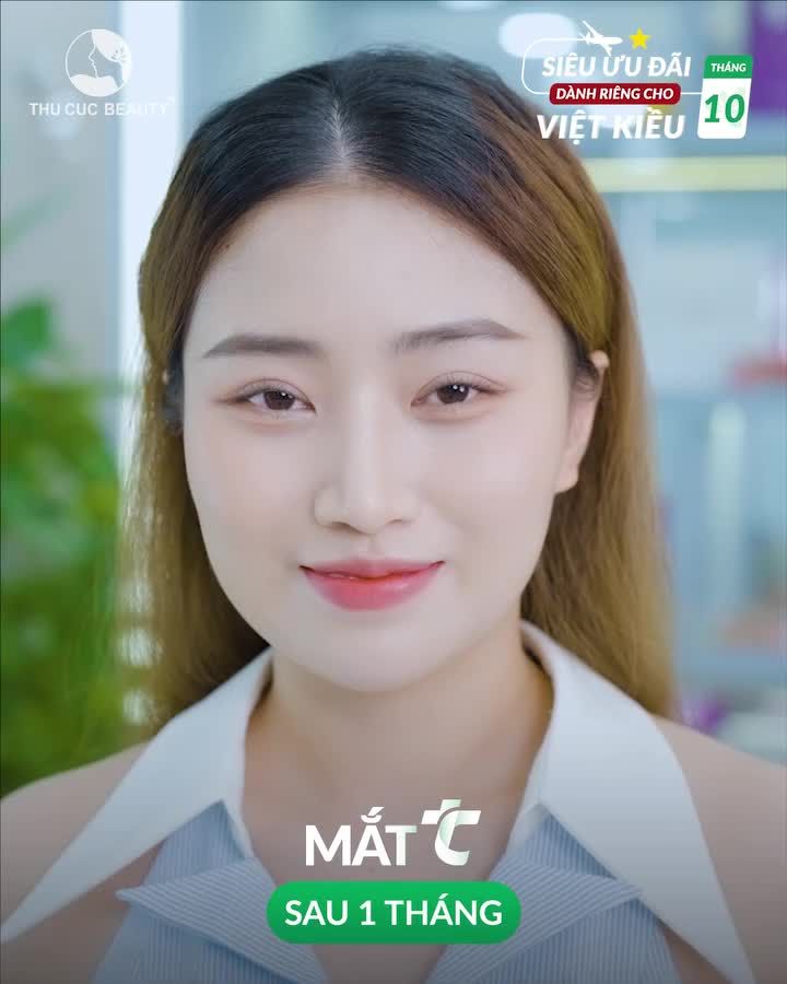 Chị em Việt Kiều tự ti vì nếp mí không đều đừng bỏ qua post này