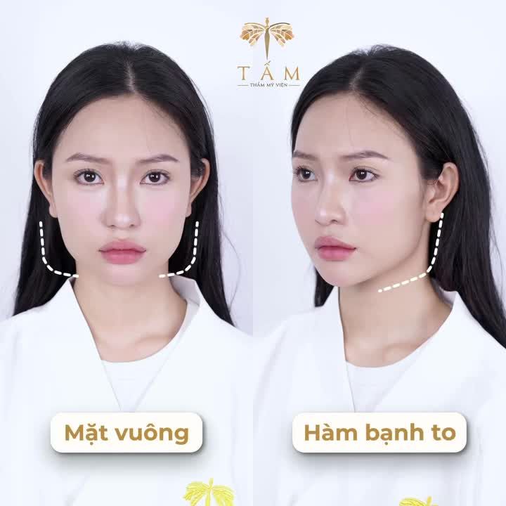 Tạo ấn tượng ban đầu, ghi điểm với người đối diện bằng khuôn hàm Vline sắc nét, mặt nhỏ xinh đẹp chuẩn hot girl, tại sao không?