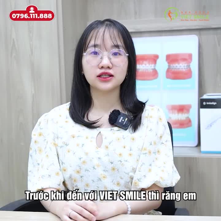 VIET SMILE ĐỊA CHỈ NIỀNG RĂNG KHÔNG LÀM BẠN THẤT VỌNG