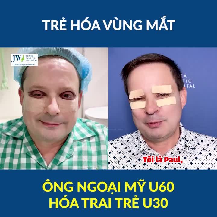 Bác sĩ Tú Dung TRẺ HOÁ VÙNG MẮT cho ông ngoại Mỹ U60 hoá TRAI TRẺ U30 siêu PHONG ĐỘ chuẩn Tổng tài