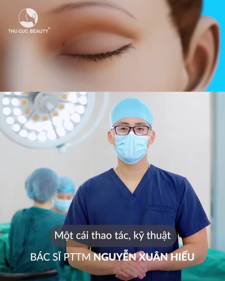 Rất nhiều KH thắc mắc Cắt mí có ảnh hưởng đến thị lực không?