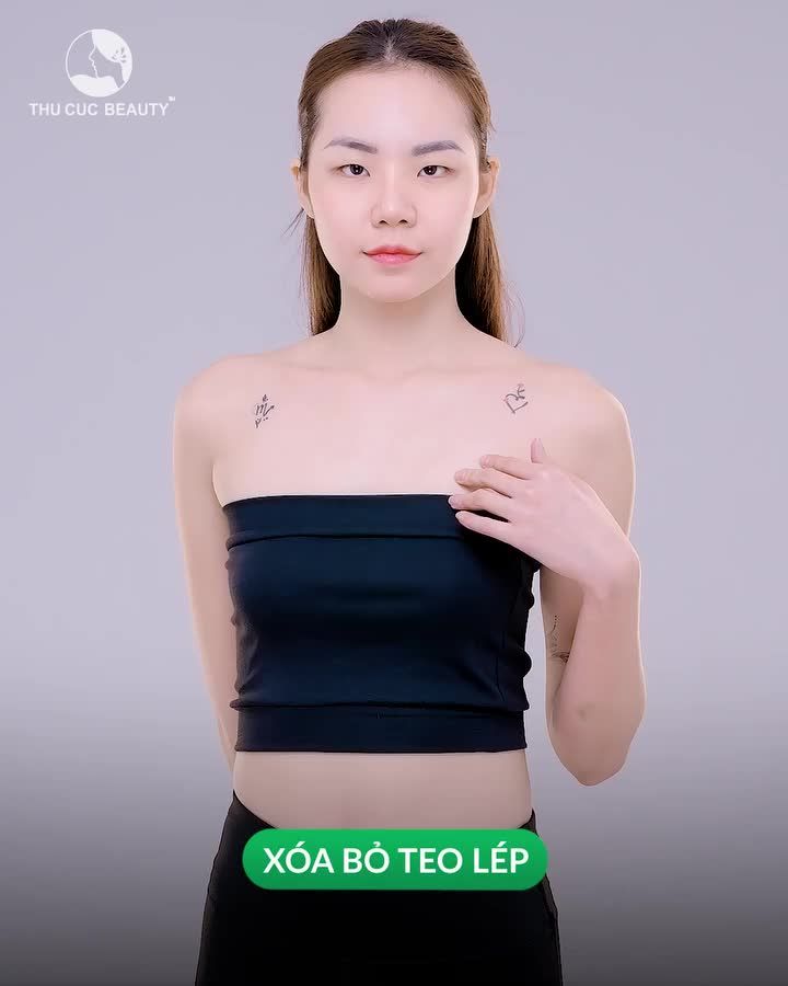 Thu Cúc đãi nâng ngực giá gốc cho chị em Việt Kiều