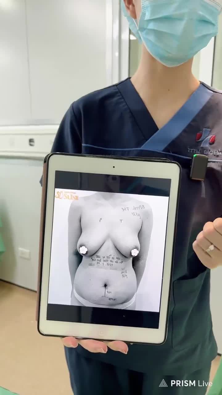 1 Livestream nhưng bao gồm kết quả của 2 ca nâng cấp V1.