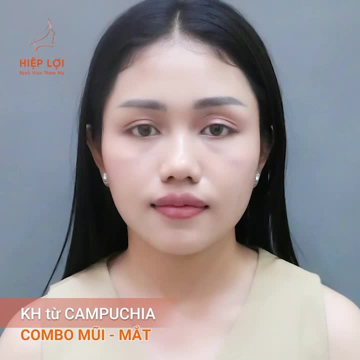 Combo MẮT - MŨI cho khách hàng từ CAMPUCHIA