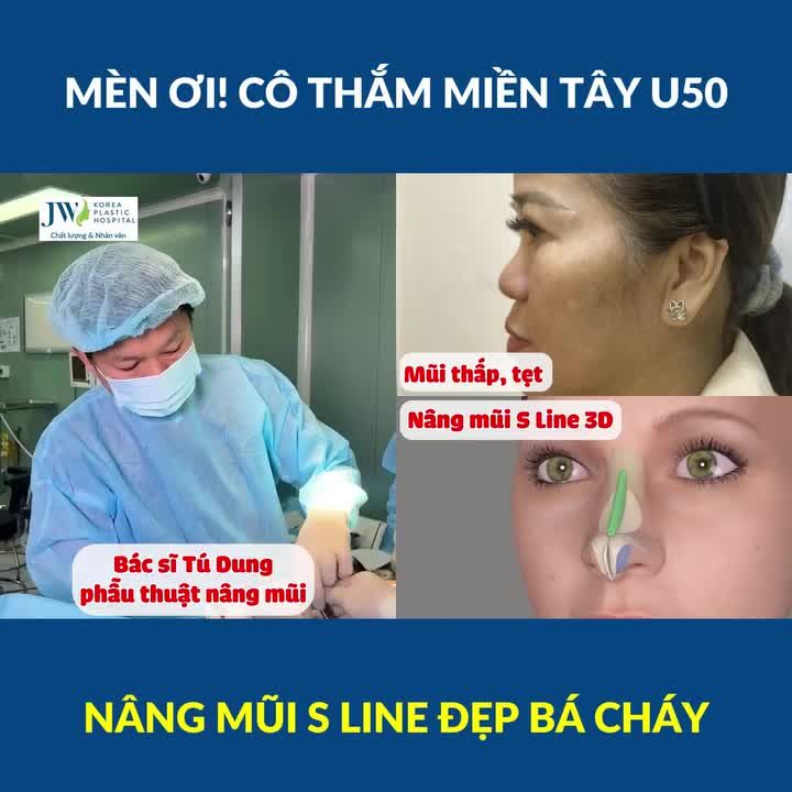 Bác sĩ Tú Dung TRẦM TRỒ kết quả NÂNG MŨI S LINE 3D ĐẸP BÁ CHÁY cho Quý bà MIỀN TÂY U50