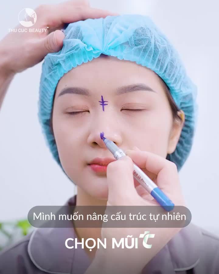 Sở hữu gương mặt cân đối hơn nhờ nâng mũi. Tiktoker Gấm Kami đã chọn Mũi TC
