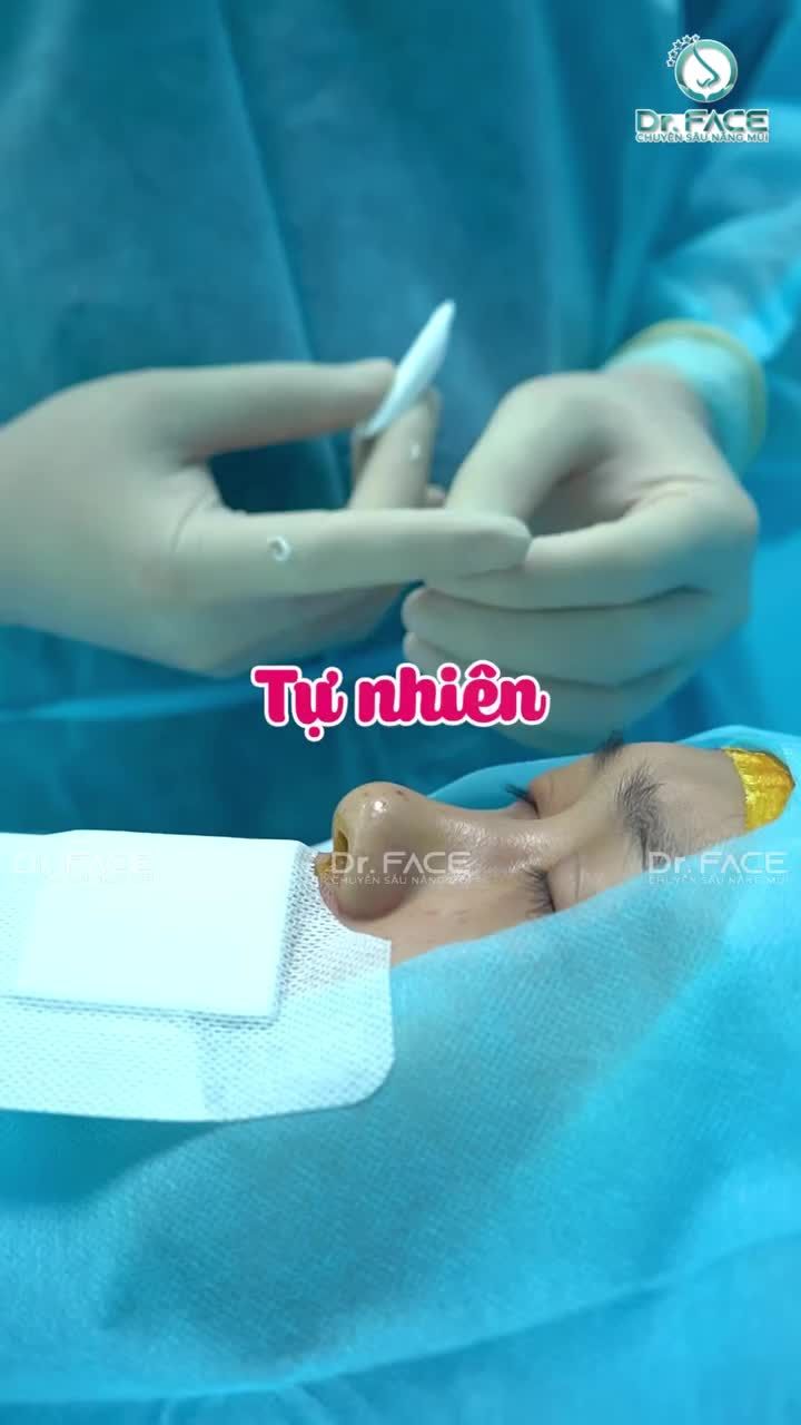 TRUNG BÌ MỠ để NÂNG MŨI đây nè…