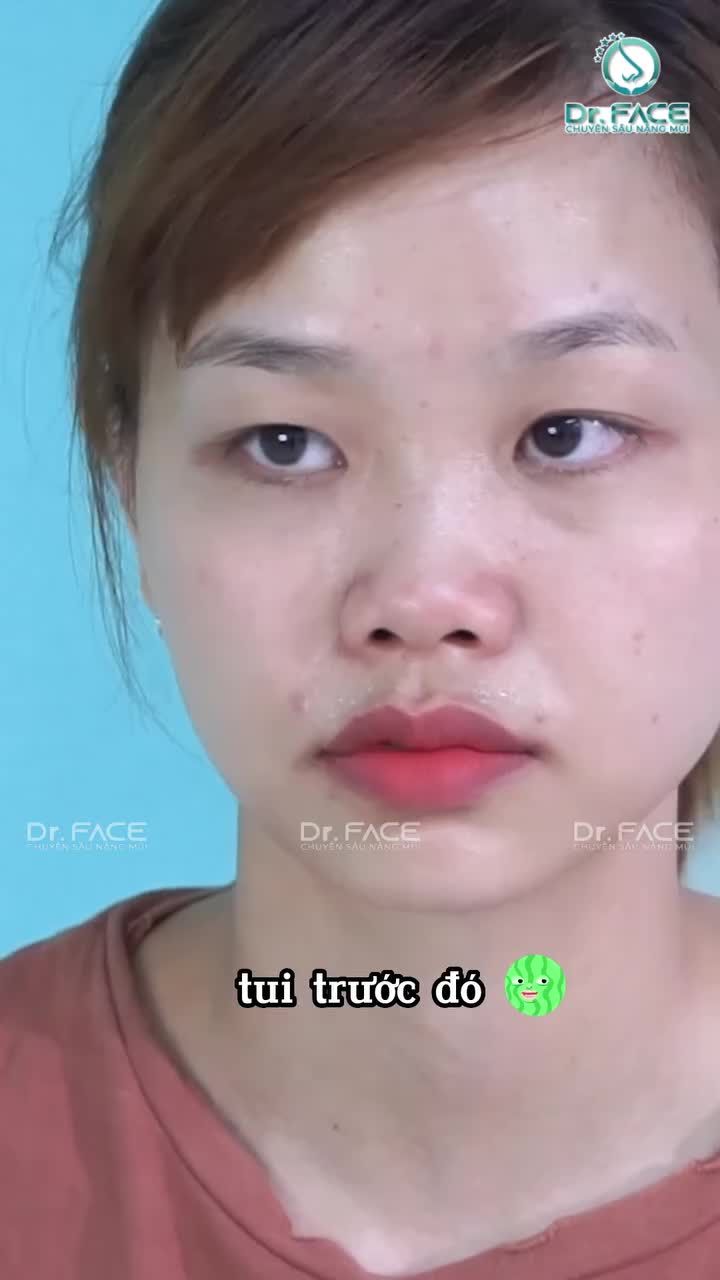 Coi MŨI MẮT TRƯỚC KIA đừng “HẾT HỒN” nha