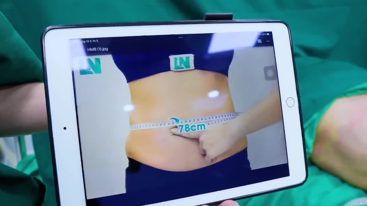 Sở hữu vòng bụng không quá lớn khoảng 87cm, tuy nhiên chị khách không hài lòng về vòng bụng của mình.