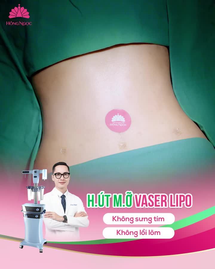 KẾT QUẢ SAU 60 PHÚT ĐỘ DÁNG CÙNG VASER LIPO CỦA CHỊ KHÁCH HẢI PHÒNG