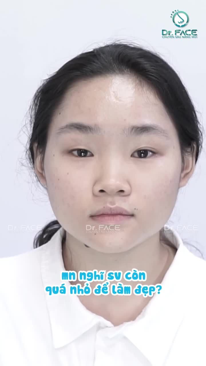 SINH VIÊN NÂNG MŨI sẽ như thế nào?