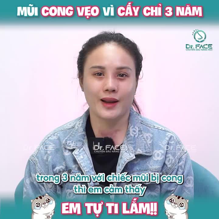 “Mũi CONG VẸO vì CẤY CHỈ 3 năm em tự ti lắm”