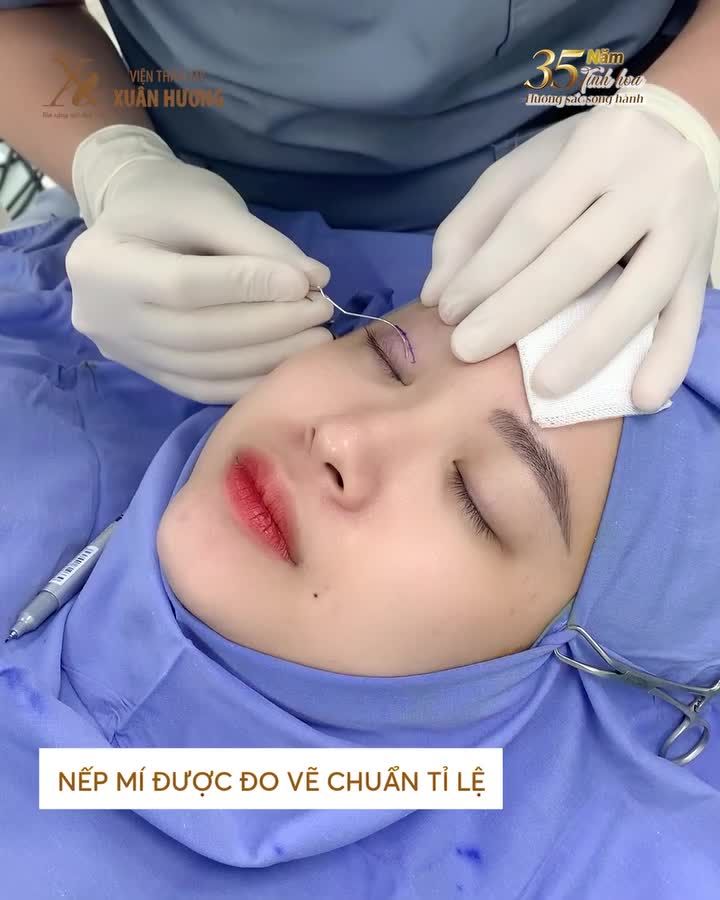 Mắt cuốn hút, thêm điểm cộng nhờ nhấn mí Eyelid Plus