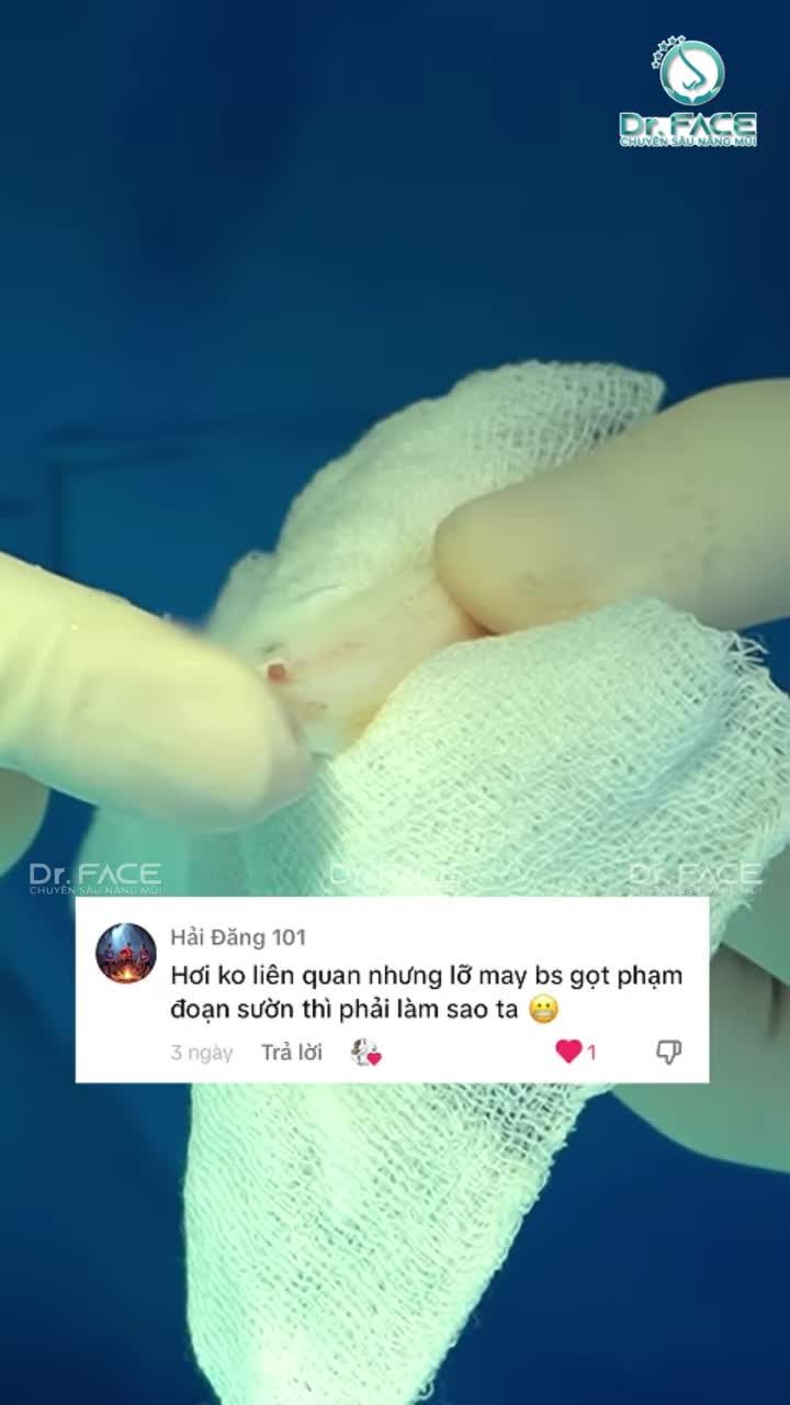 Nhìn BÁC SĨ GỌT SƯỜN sợ RỦI RO quá!