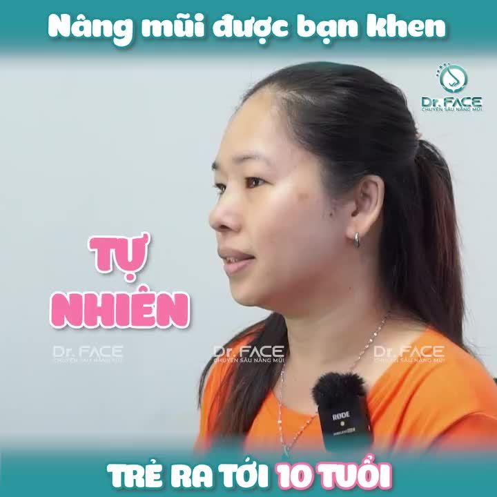 NÂNG MŨI được bạn khen TRẺ RA TỚI 10 TUỔI