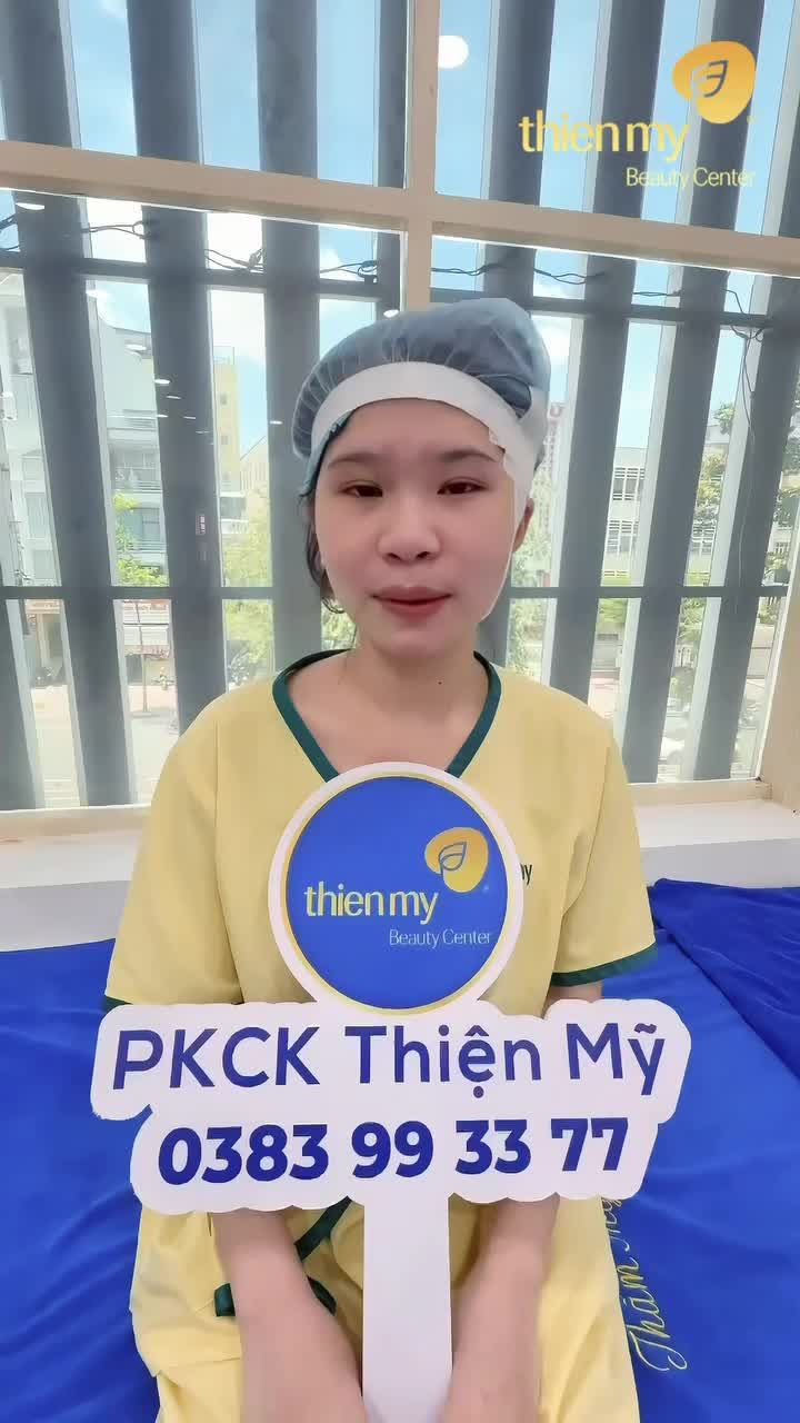 Sống mũi thấp, đầu mũi dày hãy đến ngay PKCK Thiện Mỹ