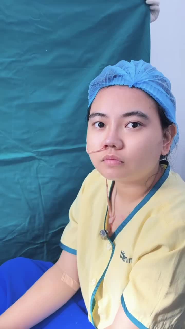 Nâng mũi cấu trúc, chia tay mũi thấp tẹt