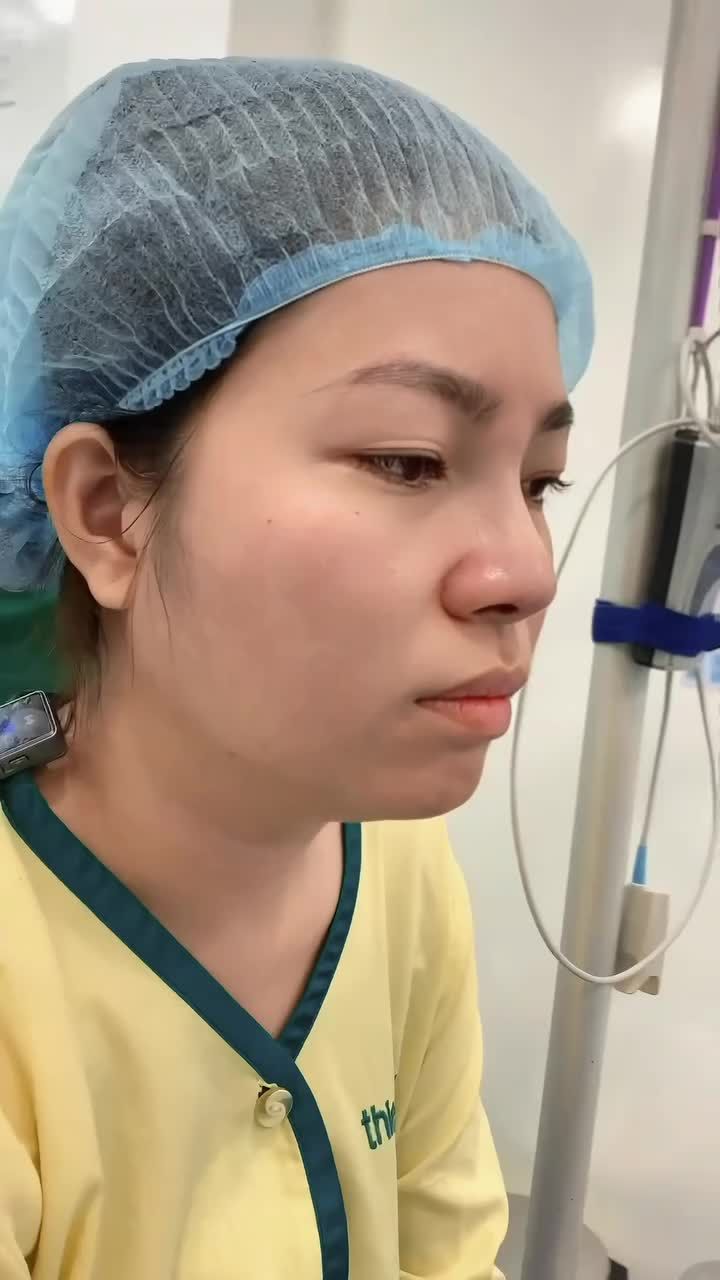 Xem ngay kết quả sau khi nâng mũi tại PKCK Thiện Mỹ