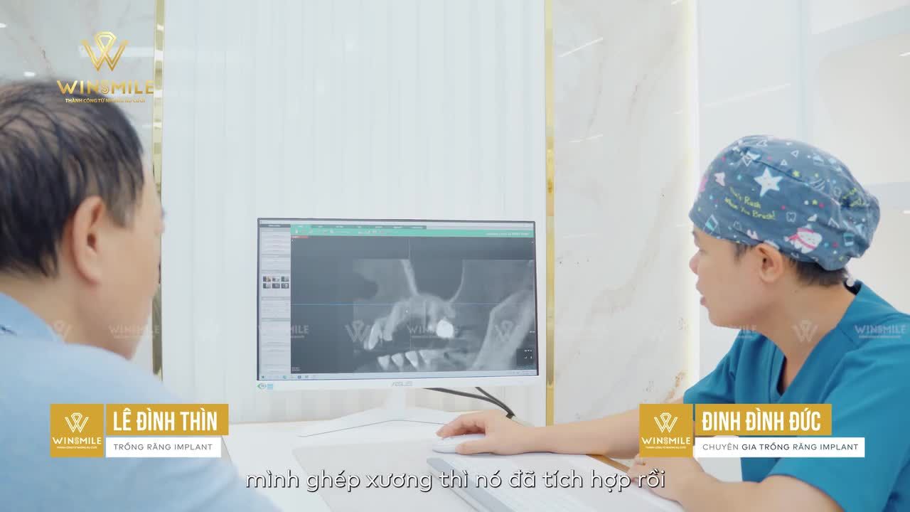 BỤC CHỈ IMPLANT DO VỆ SINH SAI CÁCH - XỬ LÝ NHƯ THẾ NÀO?