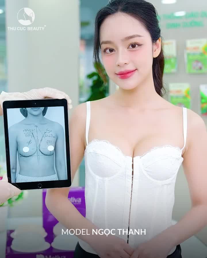 Khắc phục V1 teo lép, khe xa nhau sau 60P Click video xem ngay giải pháp