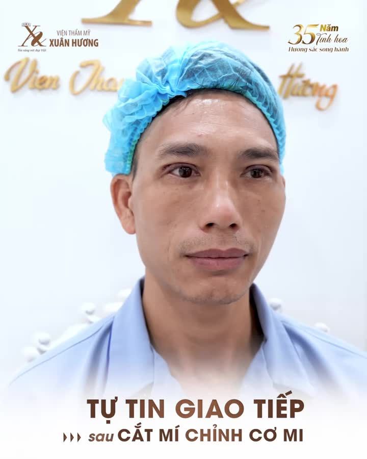 Tự tin giao tiếp sau khi cắt mí chỉnh cơ mi tại Xuân Hương