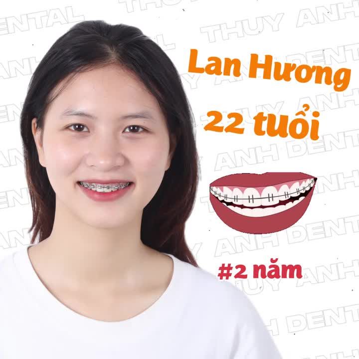 BỞI NIỀNG Ở THÙY ANH RẤT AN TOÀN NÊN SUỐT HÀNH TRÌNH 2 NĂM CỦA EM CHẲNG PHẢI LO LẮNG GÌ!