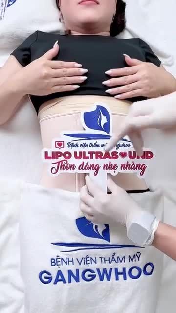 CHỊ KHÁCH HÀNG U50 TÌM LẠI ĐƯỢC THANH XUÂN NHỜ CÔNG NGHỆ GIẢM MỠ LIPO ULTRASOUND TẠI BVTM GANGWHOO