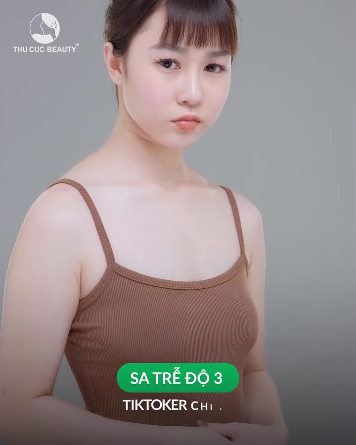Sử dụng túi ngực cao cấp chính hãng, tương thích cao với cơ thể