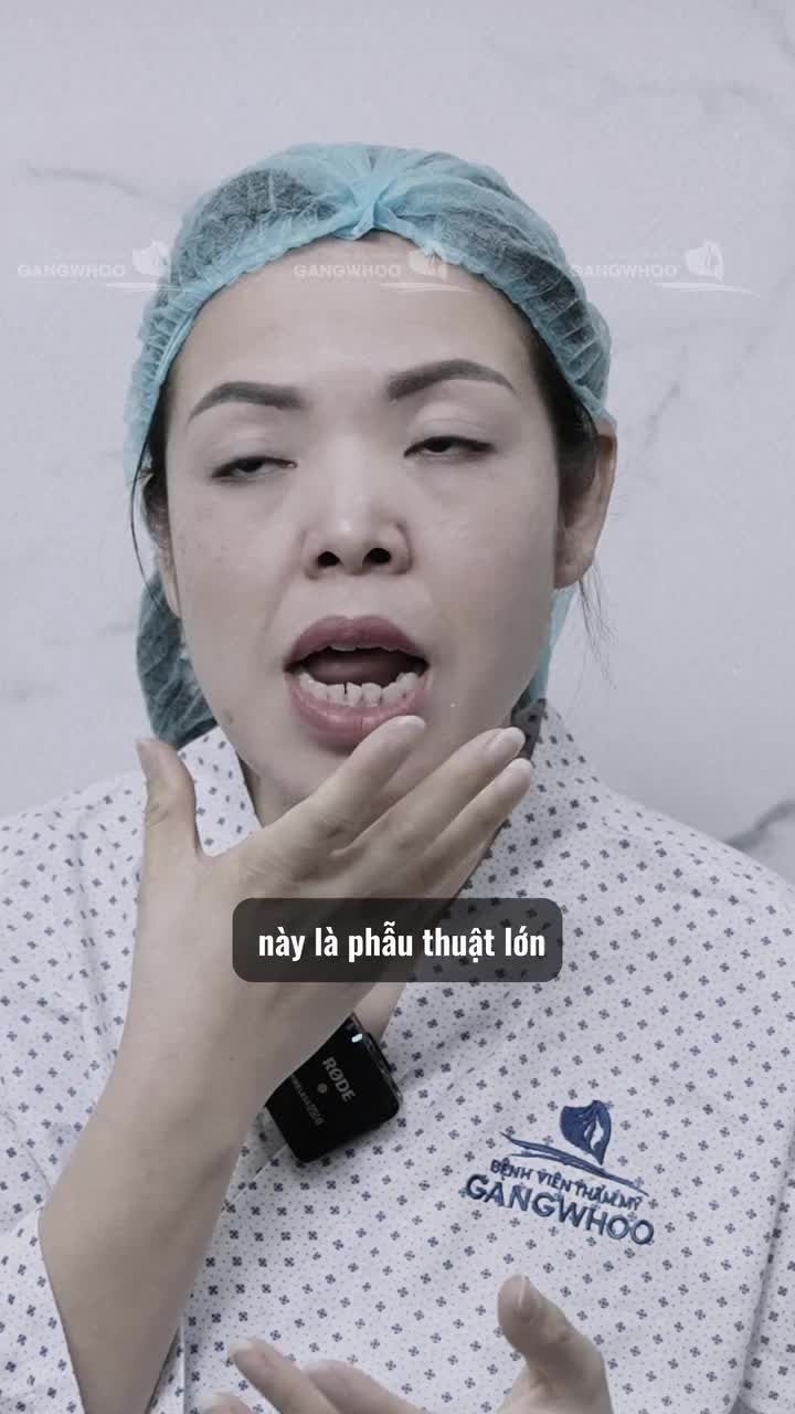 Chị B. từ Macao về Việt Nam với mong muốn chỉnh lại hàm lệch sau tai nạn năm lớp 3.