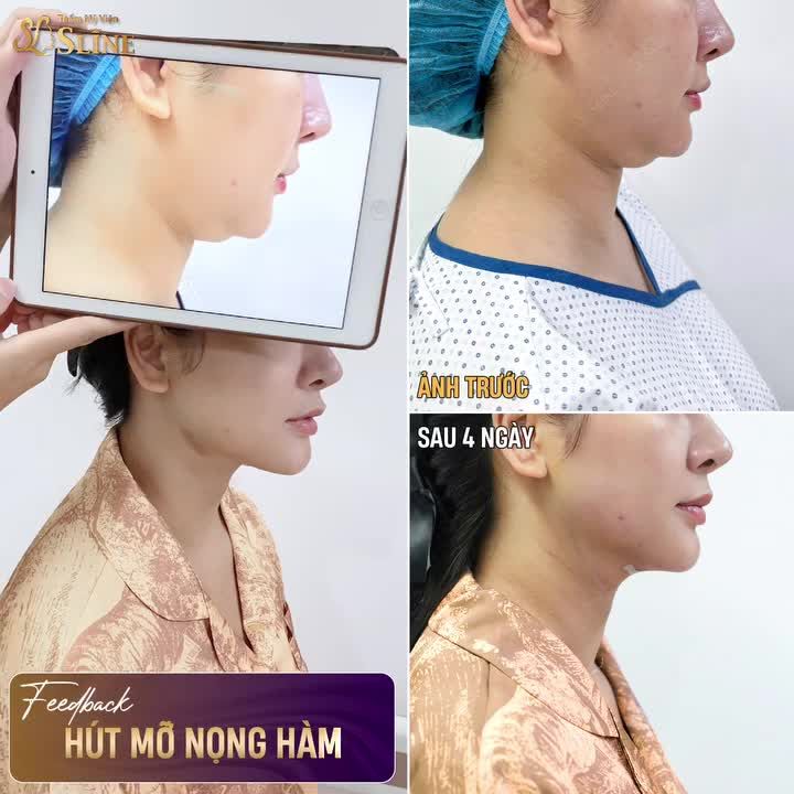 Không sợ góc chết, không cần căn ke góc chụp, càng không cần photoshop!