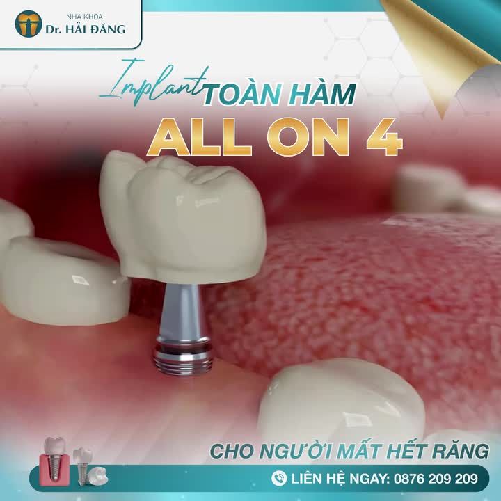 MẤT RĂNG LÀM ĐẨY NHANH QUÁ TRÌNH LÃO HÓA