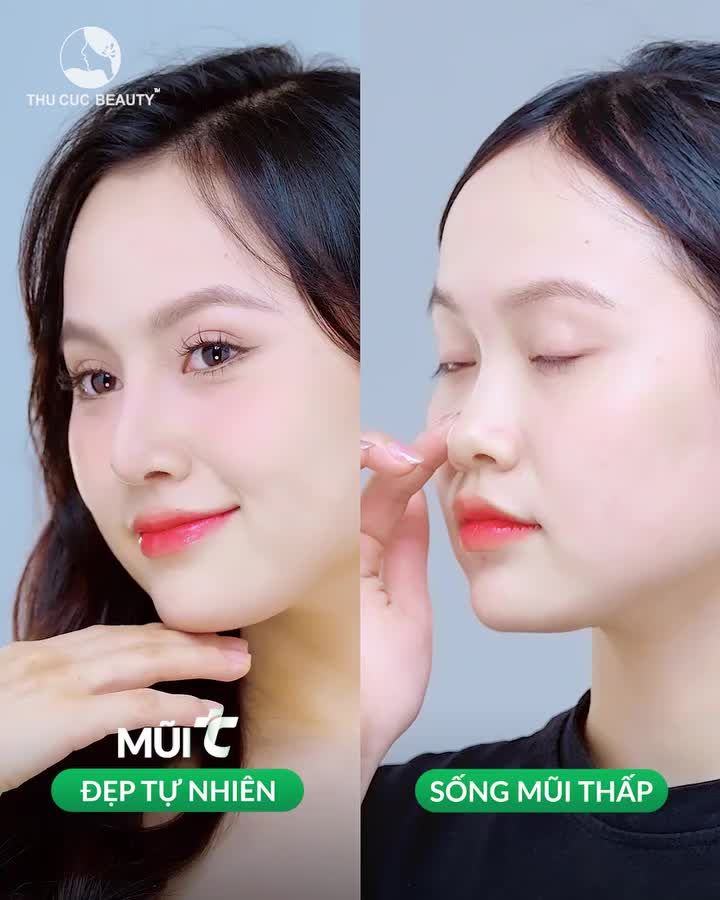 Bạn muốn có chiếc mũi đẹp cao bay hãy đến ngay TC