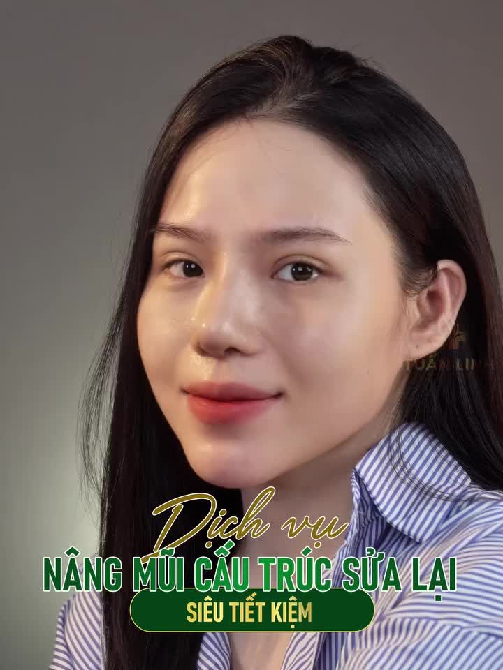Sửa lại mũi lệch - Nâng tầm nhan sắc.