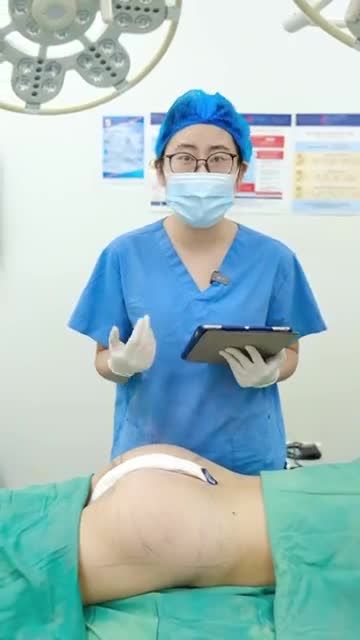 Bác sĩ Tuấn Anh vừa thực hiện 1 ca nâng cấp V3 cho khách hàng