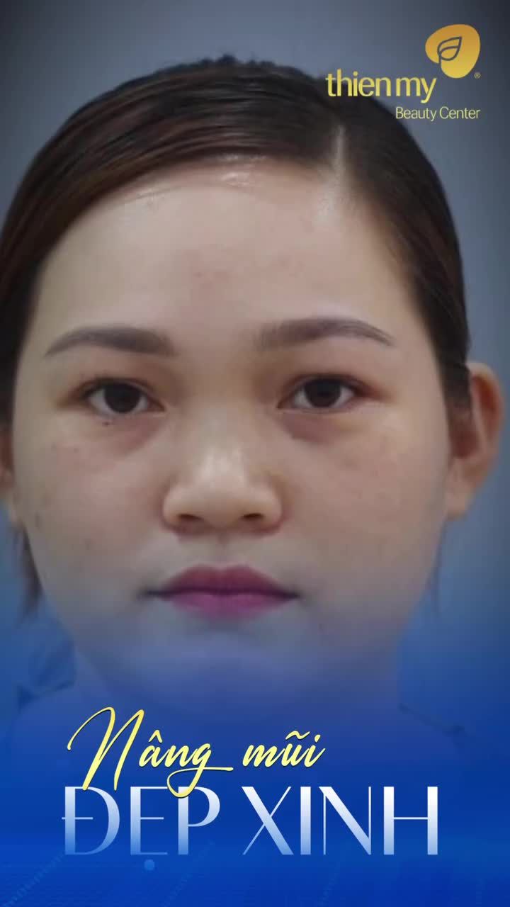 Muốn mũi đẹp kịp cuối năm đừng quên ghé qua PKCK Thiện Mỹ