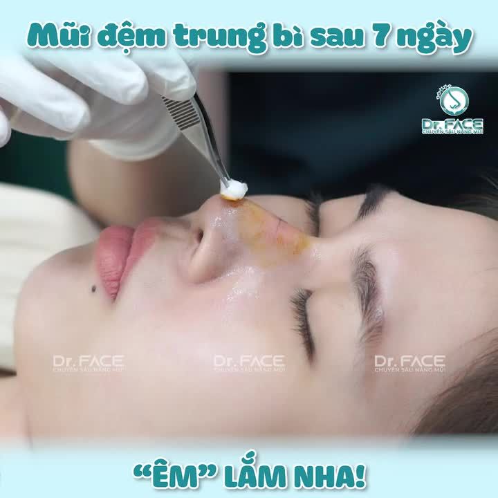 MŨI ĐỆM TRUNG BÌ SAU 7 NGÀY – “ÊM” LẮM NHA!