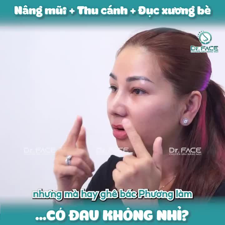 Làm Cả Nâng Mũi + Thu Cánh + Thu X ương Bè…Có Đ au Không Nhỉ